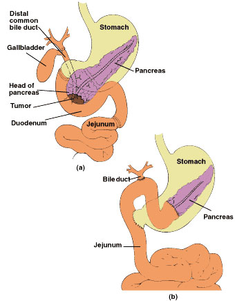 Diagram of the stomach and pancreas