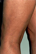 Close-up of a leg