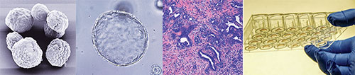 From left H&E staining of pancreatic tumor, Electron microscopy of organoid, Organoids plated as Matrigel domes, Bright field image of organoid in culture