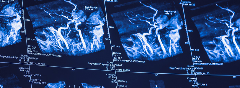 snapshot of a x-ray