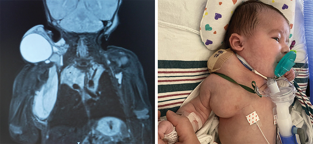 X-ray and child in hospital.