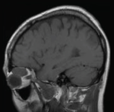xray image of top half of head