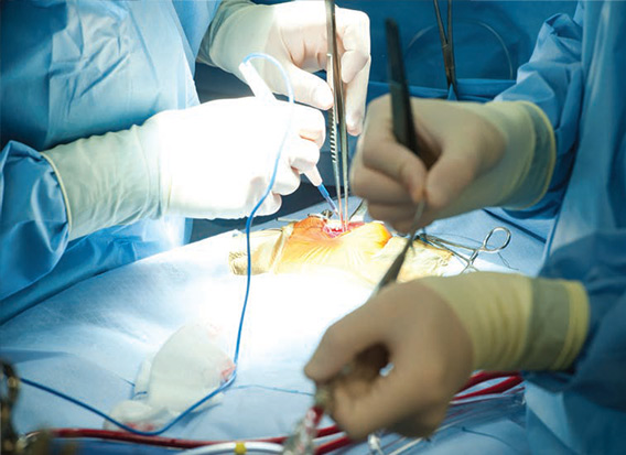closeup of surgeons during surgery