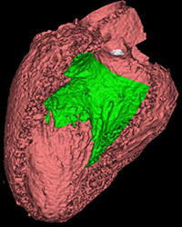 3-dimensional reconstruction of gated cardiac CT