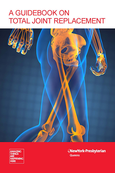 guide on total joint replacement book cover