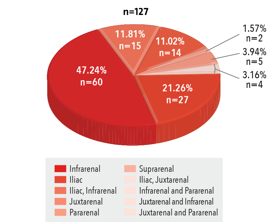 Endovascular Abdominal Aortic Repair Procedure Volume by Location 2016 pie chart