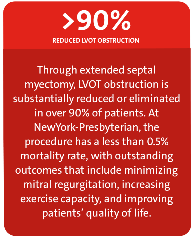 Through extended septal myectomy,
LVOT obstruction is substantially
reduced or eliminated in over 90% of
patients.