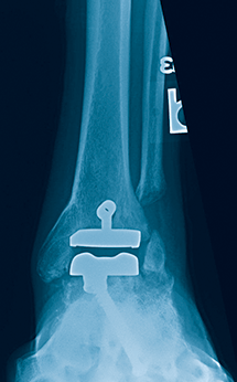 foot x-ray img 7