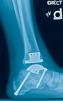 foot x-ray img 8
