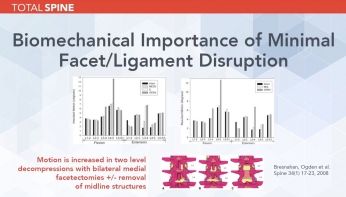 biomechanical importance of minimal facet/ligament disruptiong webinar slide