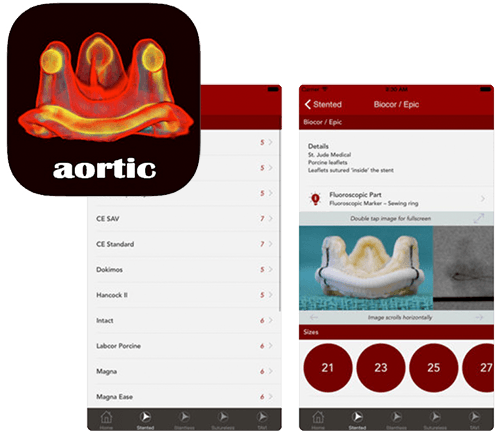aortic valve app