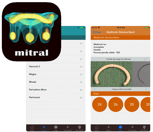 mitral valve app