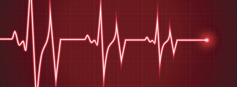 Heartbeat monitor lines 