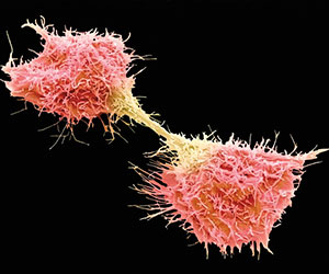 Oncology 2019 - Dividing Fibros Arcoma Cells