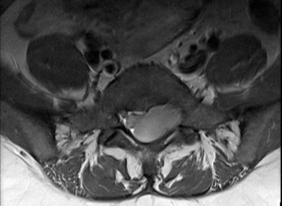 MRI image