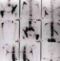 x-rays