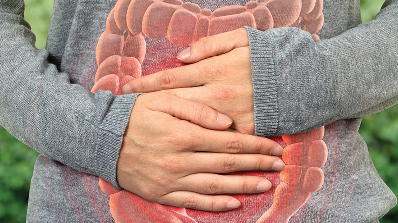 Everything You Need to Know About IBS