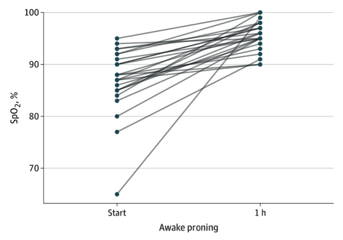 Graph displaying Oxyhemoglobin saturation (Spo2) one hour after initiation of the prone position in awake