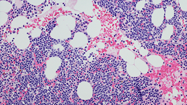 image of a microscopic section immunostain