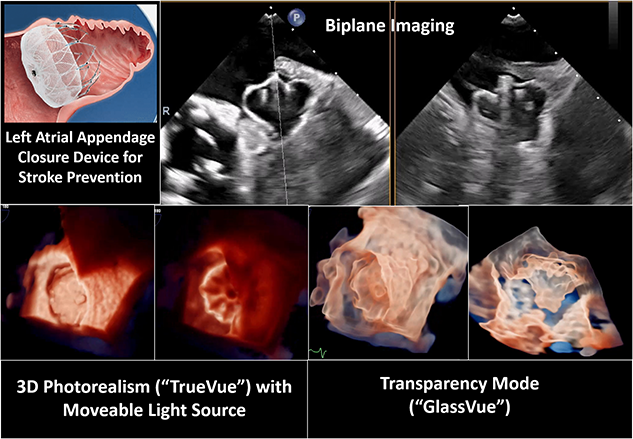 image of 3D echocardiographic imaging tools