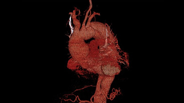 vector image of the heart