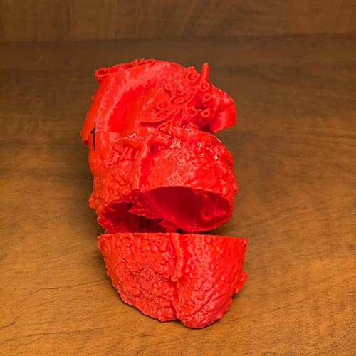 3-D printed heart used for fetal counseling