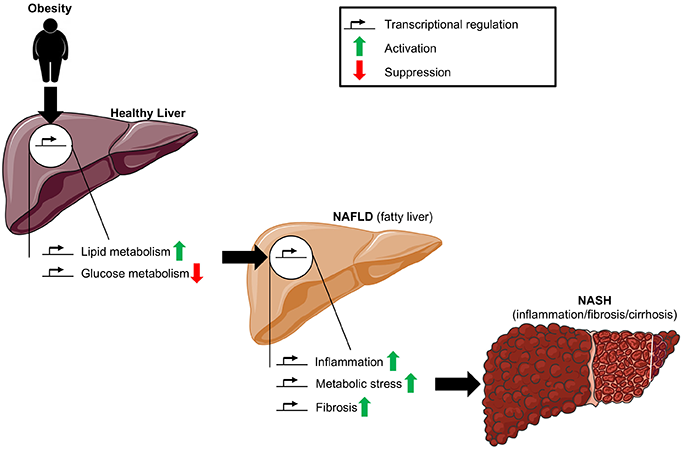 Diagram displaying how to manage fatty liver disease