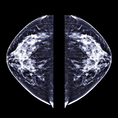 image of a digital mammogram
