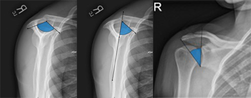image of X-ray angles