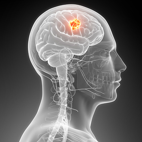 image of man's brain with a section highlighted in red