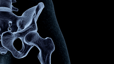 Digital medical illustration of a human hip bone