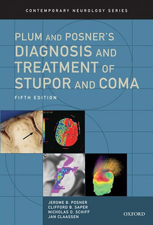 Plum and Posner's Diagnosis and Treatment of stupor and coma book cover