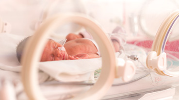image of premature newborn baby girl in the hospital incubator after c-section in 33 week
