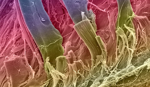digital illustration of a microscopic image of tendons attached to bone surface