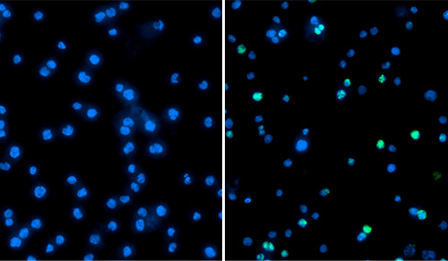 images of immunofluorescence staining of cells with and without drug treatment