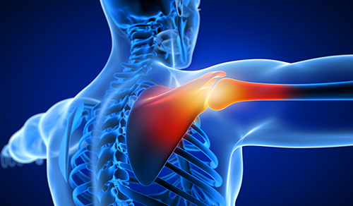 digital illustration of shoulder joint highlighted