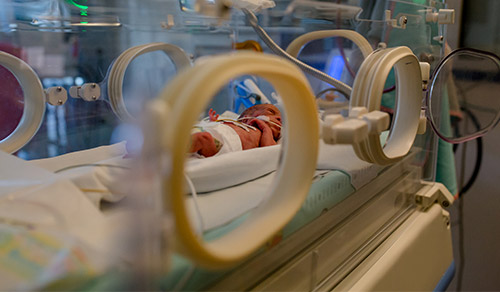 image of Premature baby in incubator