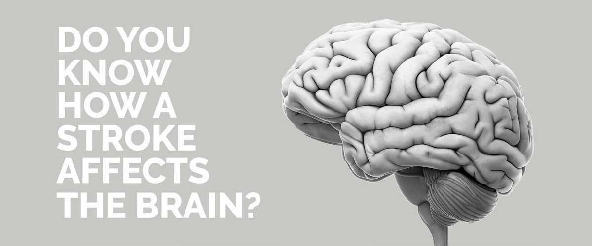 Tips to Avoid a Second Stroke