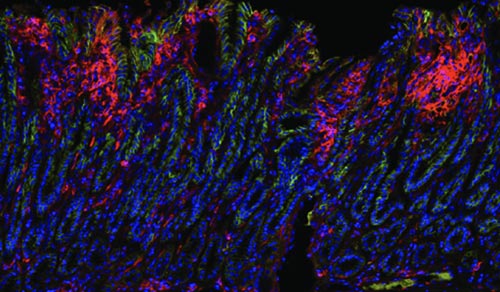 image of Stomach cancer cells from a mouse model