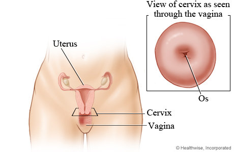 Illustrated view of a cervix.
