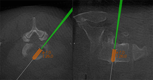 image of 3D-navigation-guided trajectory