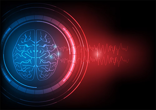vector digital illustration of human epileptic brain