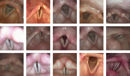 Various pictures of patients vocal folds