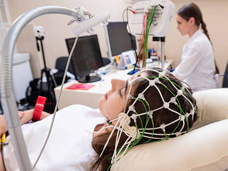 A young woman with electrodes on her scalp getting EEG readings for epilepsy