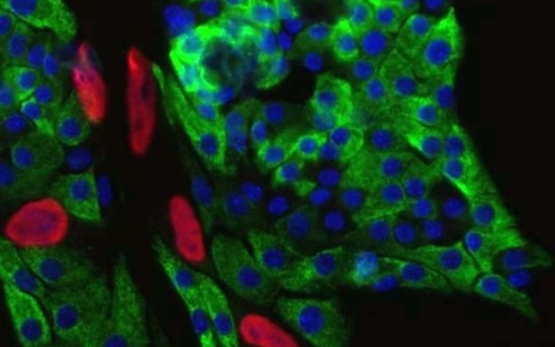 insulin-producing pancreatic beta cells