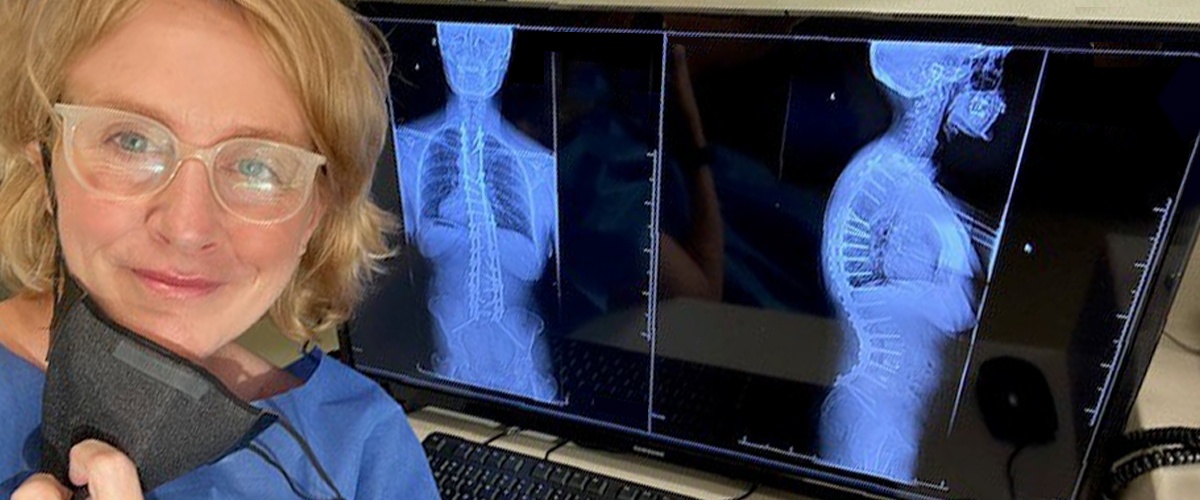 Karen McMahon smiling in front of x-rays showing her scoliosis has been cured.
