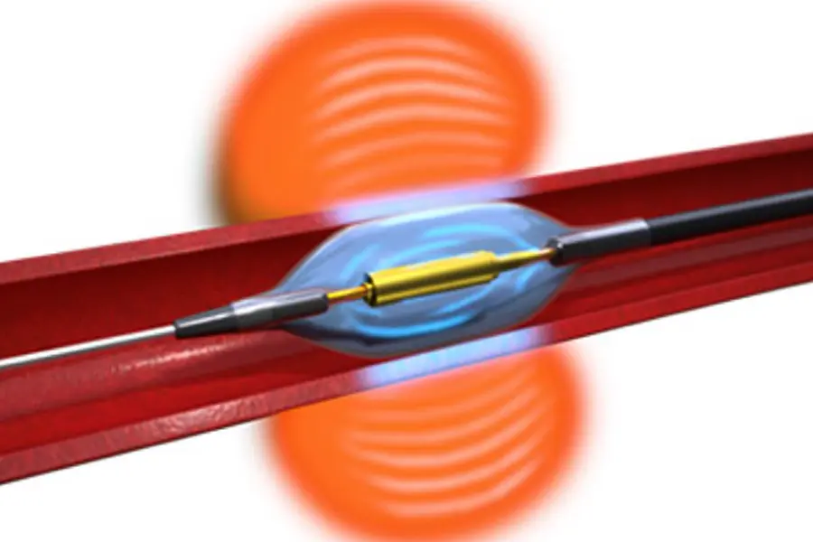 The Paradise Renal Denervation System administers ultrasound energy to the tissue surrounding the artery to decrease the signaling of overactive nerves leading to the kidney. The Hydrocooling System provides active cooling from circulating water to protect the artery (Image courtesy of Recor Medical)