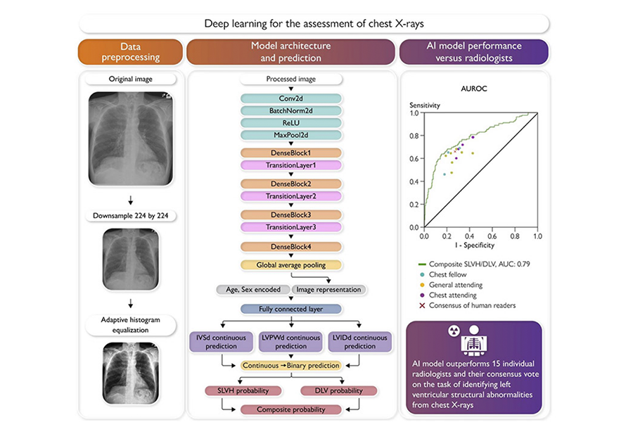 The deep learning model takes as input a pre-processed chest X-ray of dimension 224- by-224, age, and sex; the model outputs a probability for dilated left ventricle, severe left ventricular hypertrophy, and a composite label indicating the presence of either structural abnormality. (Graphical abstract from the European Heart Journal)