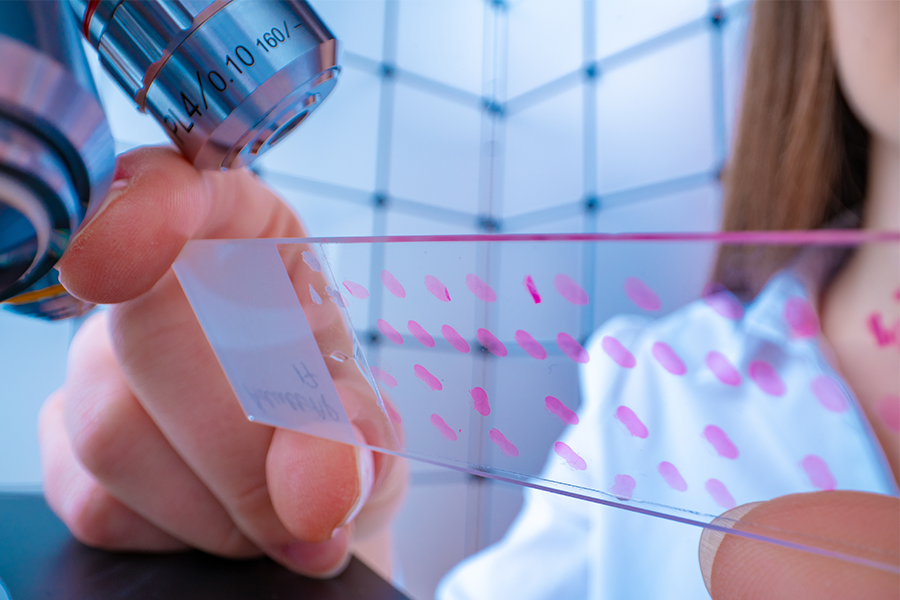 Understanding Co-Occurrence of Celiac Disease & Eosinophilic Esophagitis
