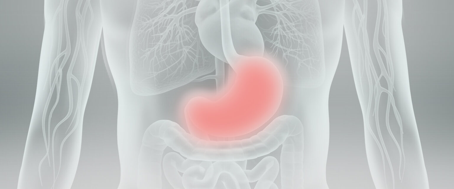 Understanding Stomach Cancer